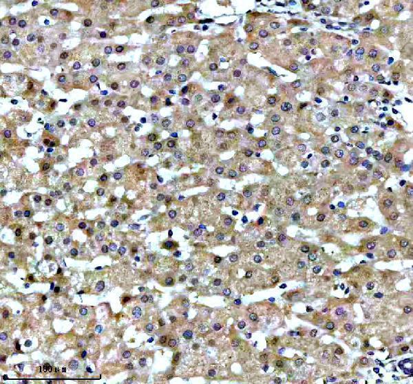 m02825 3 cbr1 primary antibodies ihc testing 3