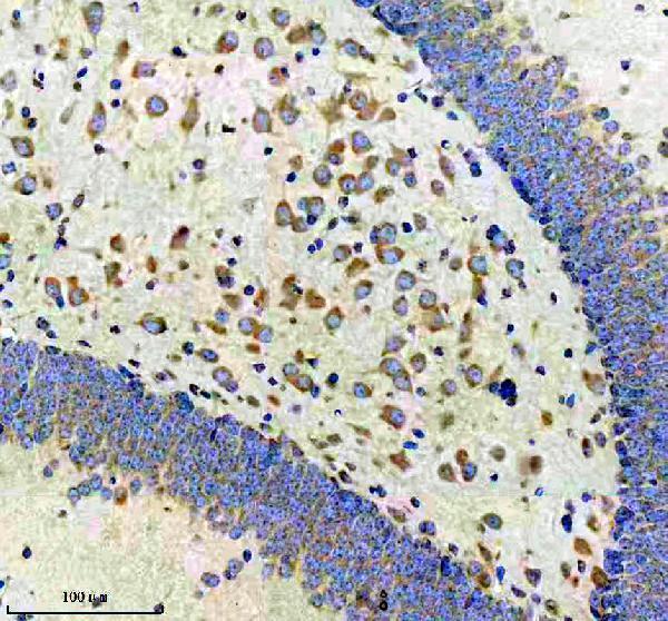m02825 3 cbr1 primary antibodies ihc testing 4