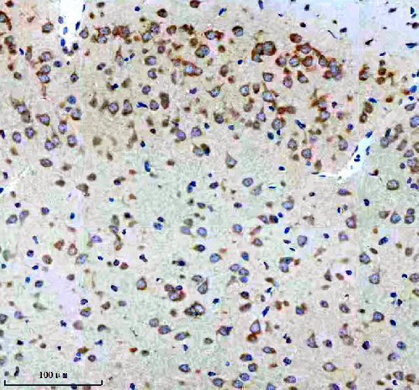 m02825 3 cbr1 primary antibodies ihc testing 5