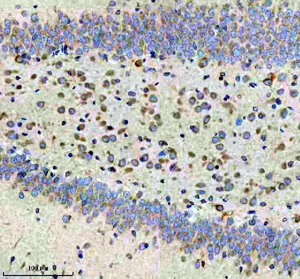 m02825 3 cbr1 primary antibodies ihc testing 6