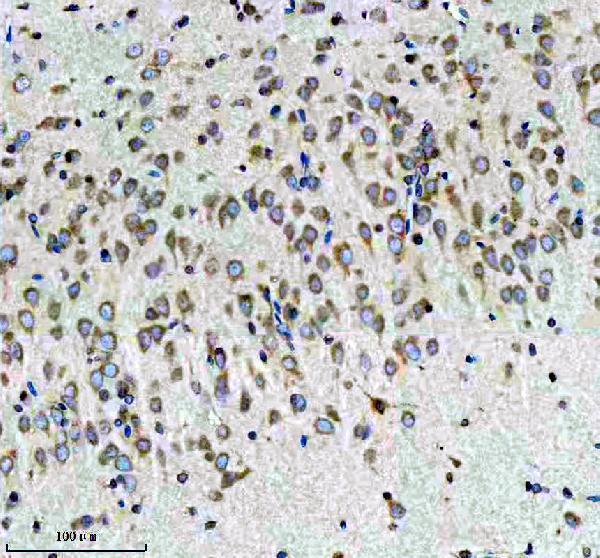 m02825 3 cbr1 primary antibodies ihc testing 7