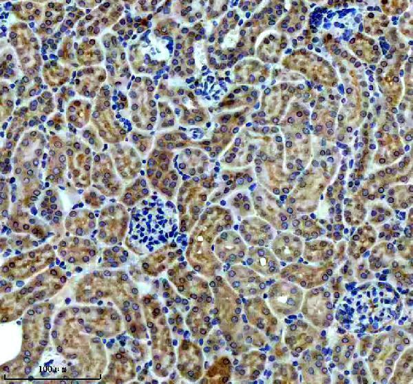 IHC analysis of CBR1 using anti-CBR1 antibody (M02825-3)