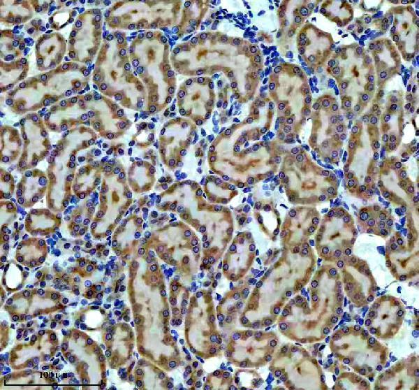 IHC analysis of CBR1 using anti-CBR1 antibody (M02825-3)