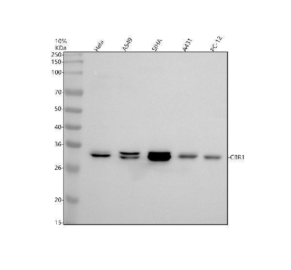 Western blot analysis of CBR1 using anti-CBR1 antibody (M02825-3)