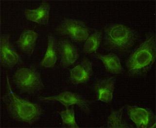m02825 cbr1 primary antiboties icc testing 3
