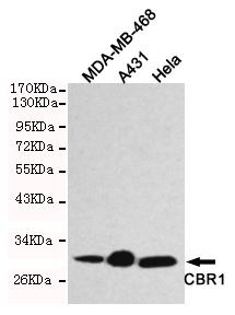 m02825 cbr1 primary antiboties wb testing 1