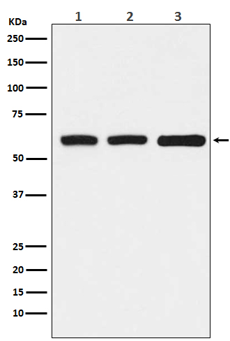 Western blot analysis of KAT9 / Elp3 expression in (1) HeLa cell lysate; (2) RAW264