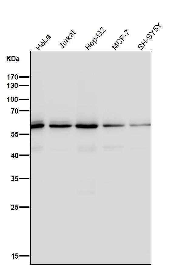 All lanes use the Antibody at 1:3K dilution for 1 hour at room temperature