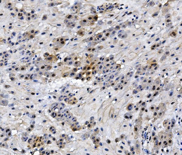 m02834 hmgb3 primary antibodies ihc testing 2_1