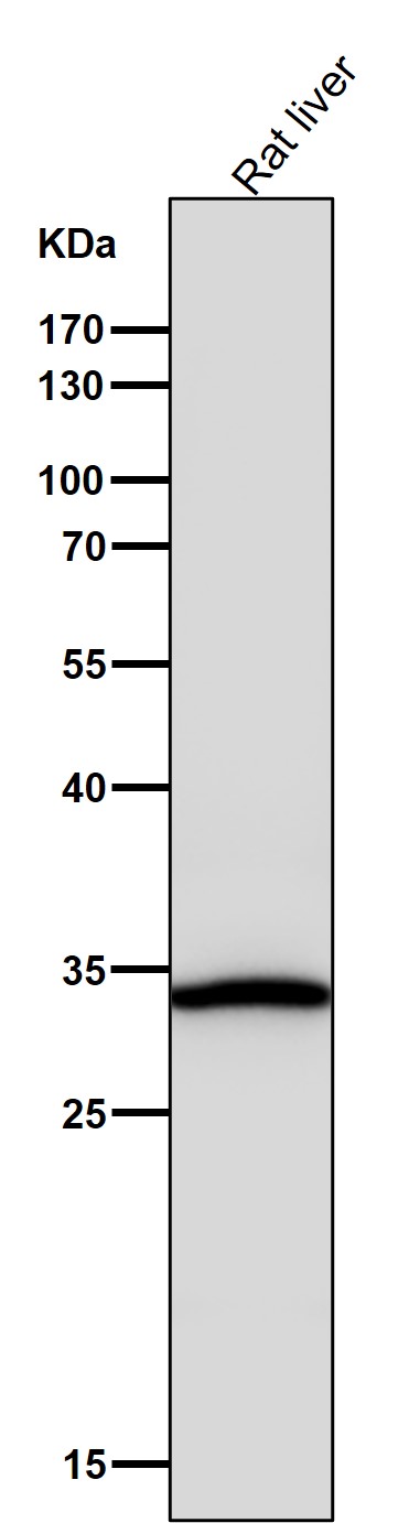 All lanes use the Antibody at 1:5K dilution for 1 hour at room temperature