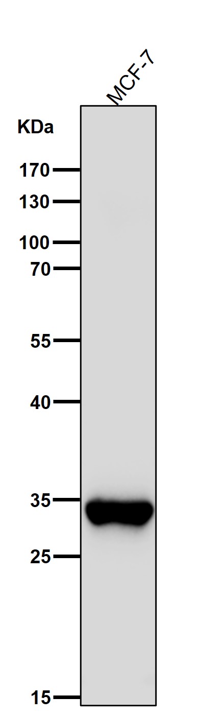 All lanes use the Antibody at 1:5K dilution for 1 hour at room temperature