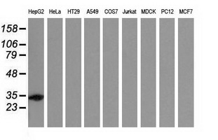 m02839 anti sult2a1 mouse monoclonal antibody clone id oti4d7 wb testing 3