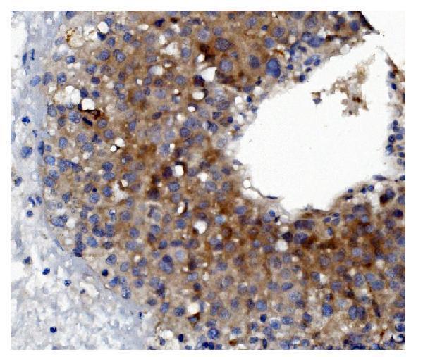  IHC analysis of GSDMD using anti-GSDMD antibody (M02842-1)