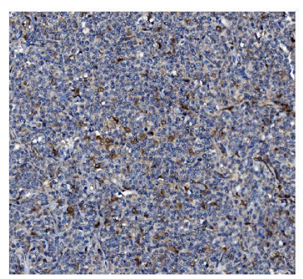 m02842 1 gsdmd primary antibodies ihc testing 4
