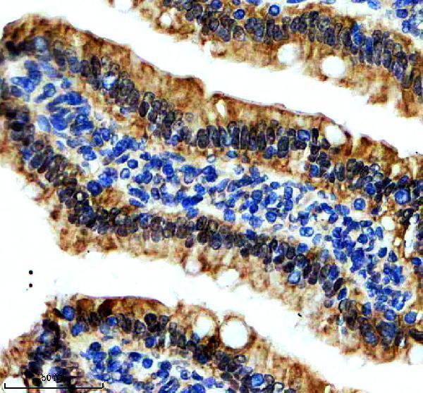 IHC analysis of GSDMD using anti-GSDMD antibody (M02842-2)