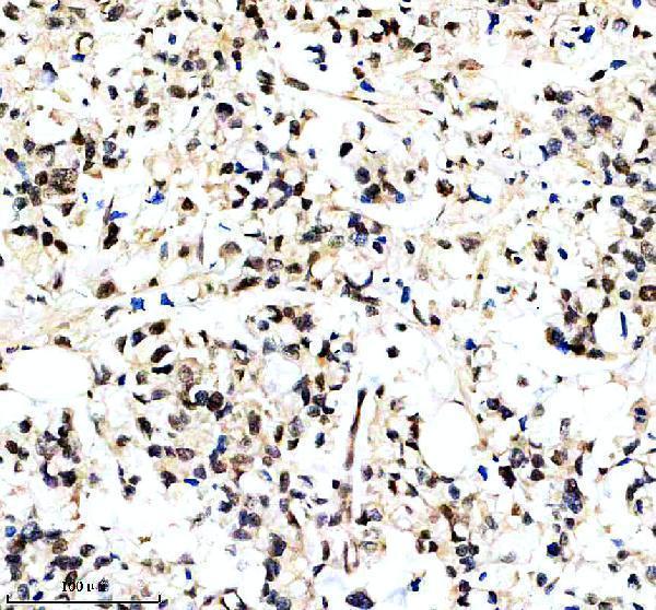 IHC analysis of GSDMD using anti-GSDMD antibody (M02842-2)