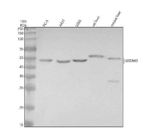 Western blot analysis of GSDMD using anti-GSDMD antibody (M02842-2)