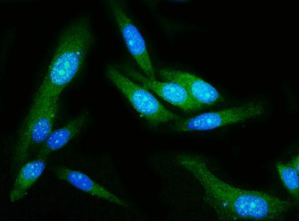 m02842 gsdmd primary antibodies if testing 5