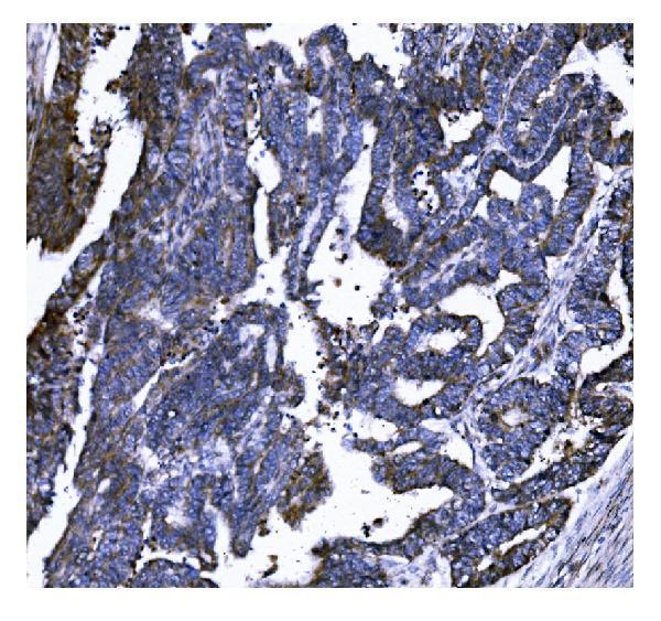  IHC analysis of GSDMD using anti-GSDMD antibody (M02842)