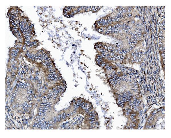  IHC analysis of GSDMD using anti-GSDMD antibody (M02842)