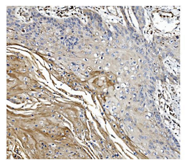 m02842 gsdmd primary antibodies ihc testing 4