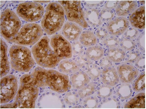 m02846 2 psma primary antibodies ihc testing 2