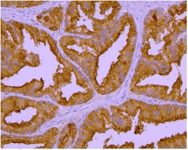 m02846 2 psma primary antibodies ihc testing 3