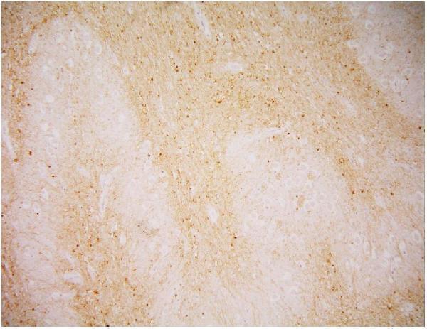 m02846 2 psma primary antibodies ihc testing 4