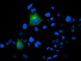 m02846 3 anti psma folh1 mouse monoclonal antibody clone id oti3h5 if testing 6