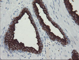 m02846 3 anti psma folh1 mouse monoclonal antibody clone id oti3h5 ihc testing 4