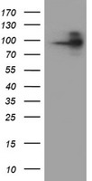 HEK293T cells were transfected with the pCMV6-ENTRY control (Left lane) or pCMV6-ENTRY FOLH1 (Right lane) cDNA for 48 hrs and lysed