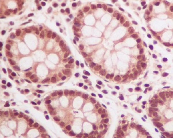 Immunohistochemical analysis of paraffin-embedded human colon, using Ubiquitin Antibody.