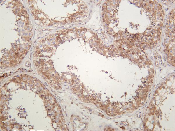 m02848 6 ubiquitin k48 primary antibodies ihc testing 1