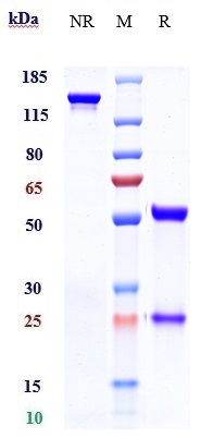 Anti-AOC3/VAP1 Reference Antibody (timolumab) on SDS-PAGE under reducing (R) condition