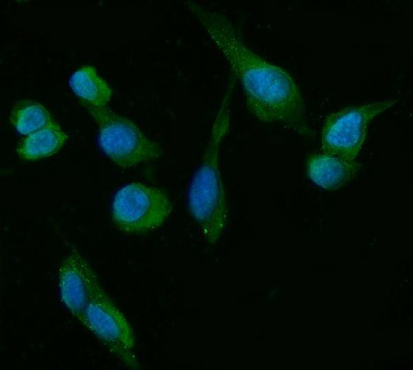  IF analysis of HSD3B1 using anti-HSD3B1 antibody (M02856)