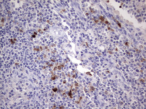 Immunohistochemical staining of paraffin-embedded Human lymph node tissue within the normal limits using anti-RSPO1 mouse monoclonal antibody