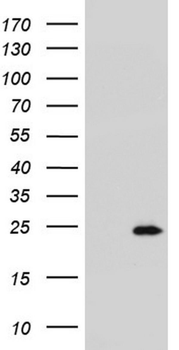 HEK293T cells were transfected with the pCMV6-ENTRY control (Left lane) or pCMV6-ENTRY RSPO1 (Right lane) cDNA for 48 hrs and lysed