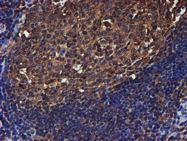 Immunohistochemical staining of paraffin-embedded Human tonsil within the normal limits using anti-PSMB9 mouse monoclonal antibody