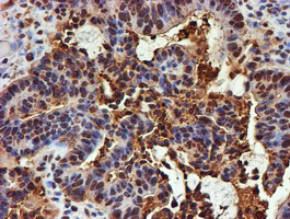 m02867 1 anti psmb9 mouse monoclonal antibody clone id oti2b6 ihc testing 13