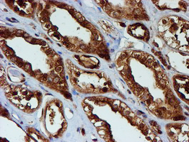m02867 1 anti psmb9 mouse monoclonal antibody clone id oti2b6 ihc testing 14