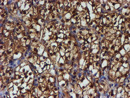 m02867 1 anti psmb9 mouse monoclonal antibody clone id oti2b6 ihc testing 15