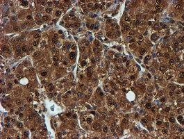 m02867 1 anti psmb9 mouse monoclonal antibody clone id oti2b6 ihc testing 16