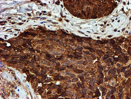 m02867 1 anti psmb9 mouse monoclonal antibody clone id oti2b6 ihc testing 3