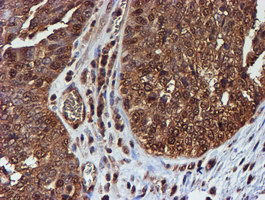 m02867 1 anti psmb9 mouse monoclonal antibody clone id oti2b6 ihc testing 4