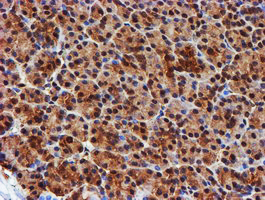 m02867 1 anti psmb9 mouse monoclonal antibody clone id oti2b6 ihc testing 5