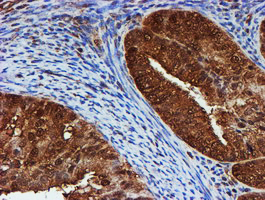 m02867 1 anti psmb9 mouse monoclonal antibody clone id oti2b6 ihc testing 6