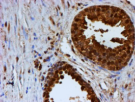 m02867 1 anti psmb9 mouse monoclonal antibody clone id oti2b6 ihc testing 7