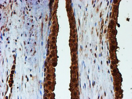 m02867 1 anti psmb9 mouse monoclonal antibody clone id oti2b6 ihc testing 8