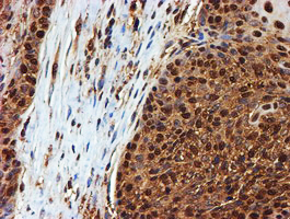m02867 1 anti psmb9 mouse monoclonal antibody clone id oti2b6 ihc testing 9