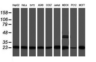 m02867 1 anti psmb9 mouse monoclonal antibody clone id oti2b6 wb testing 2